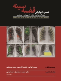 تفسیر رادیوگرافی قفسه سینه